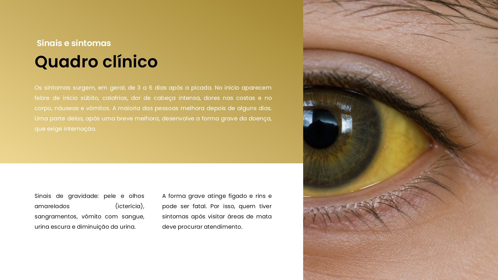 Febre Amarela – slide 8