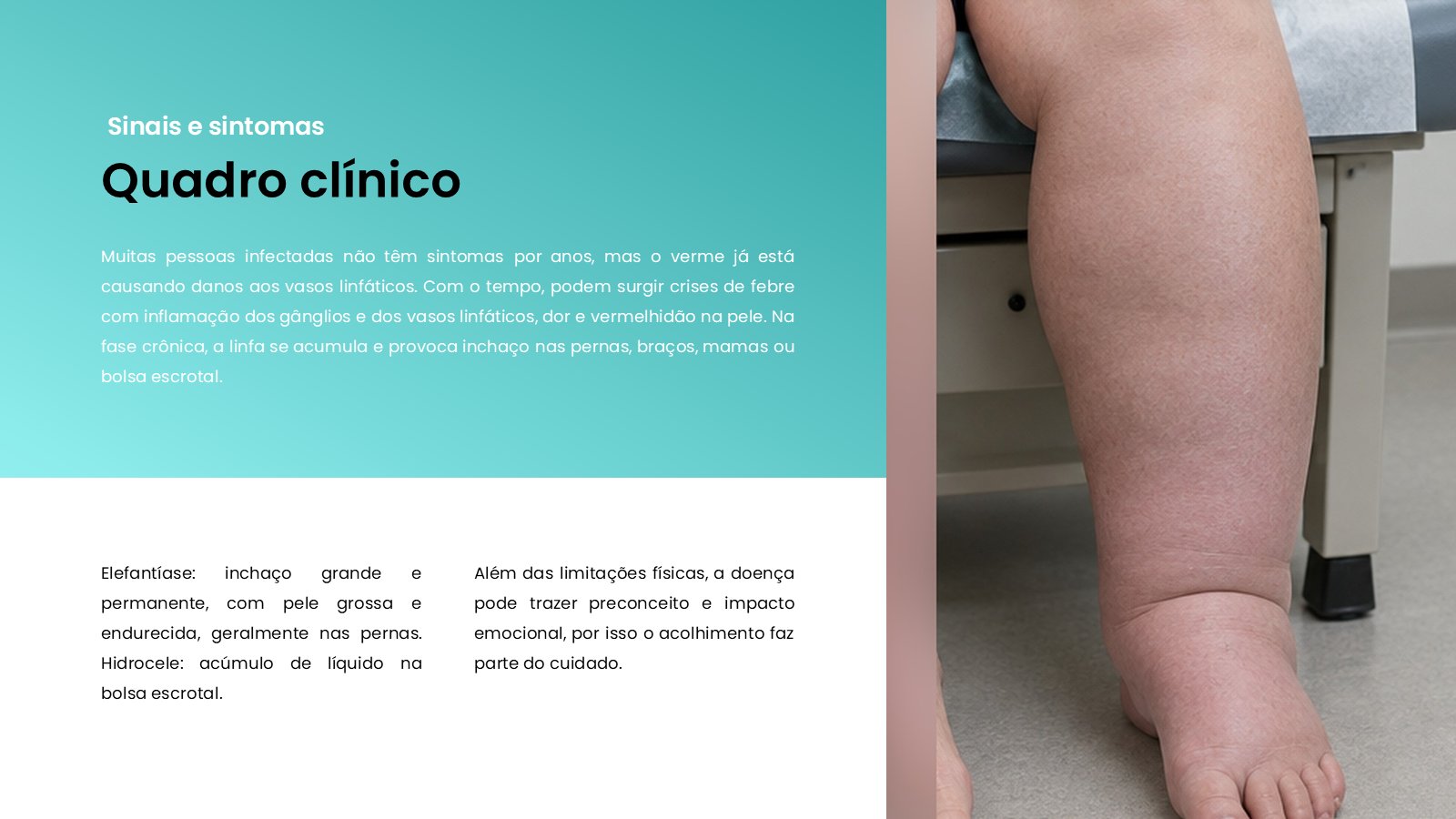 Filariose – slide 8