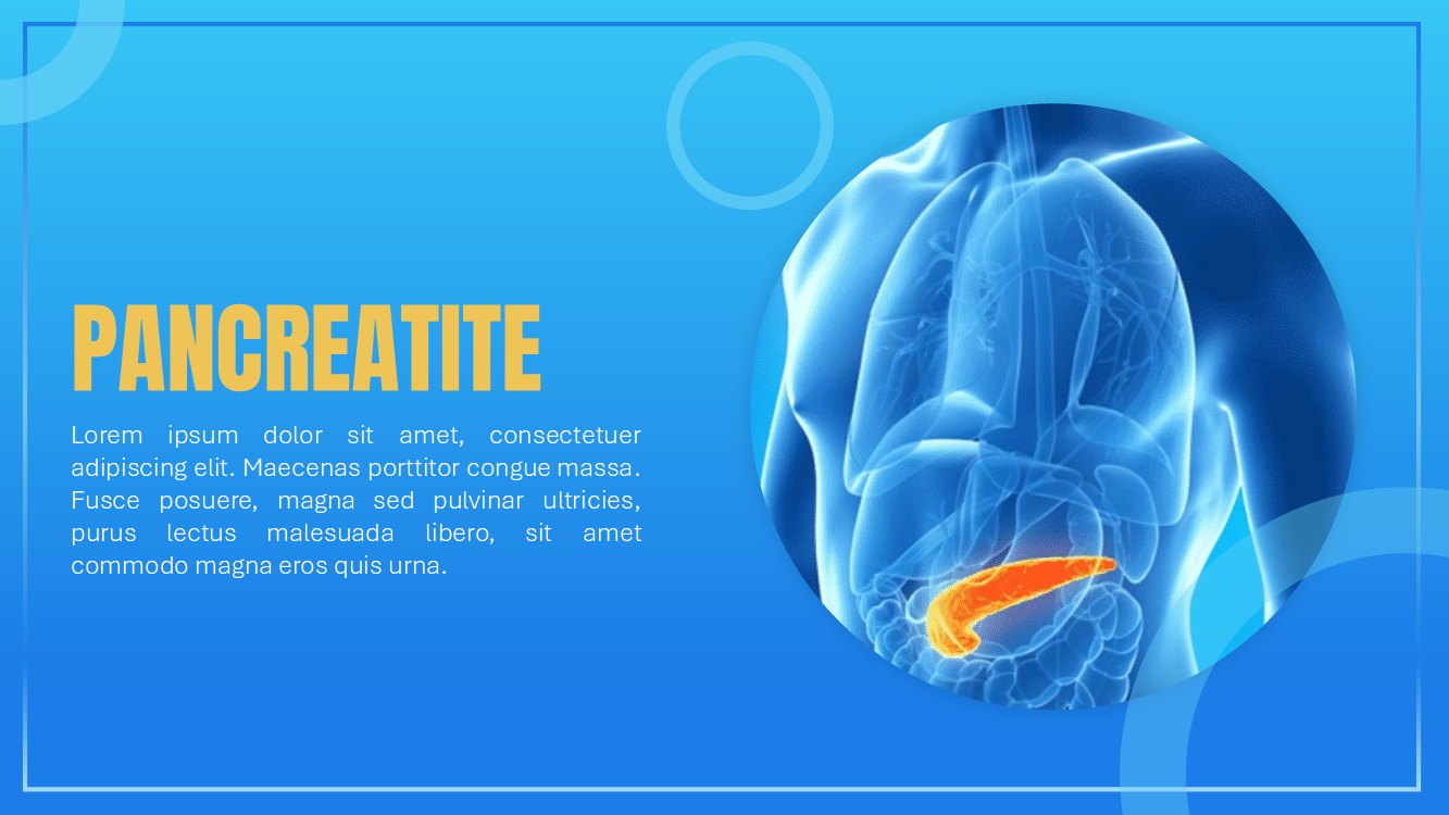 pancreatite-slide1