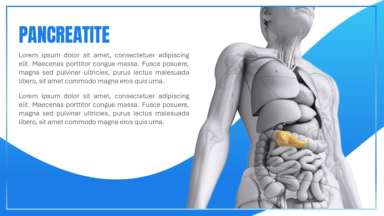 pancreatite-slide3