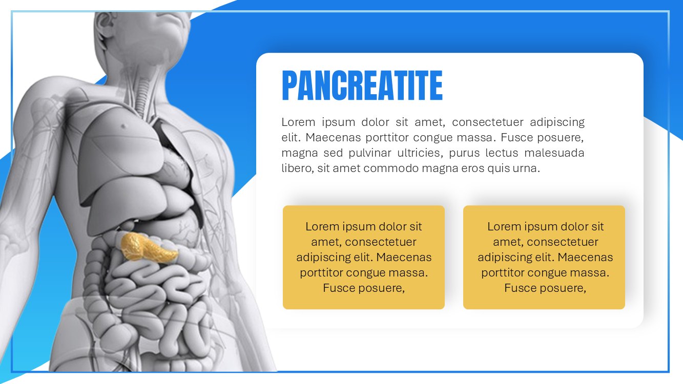 pancreatite-slide4