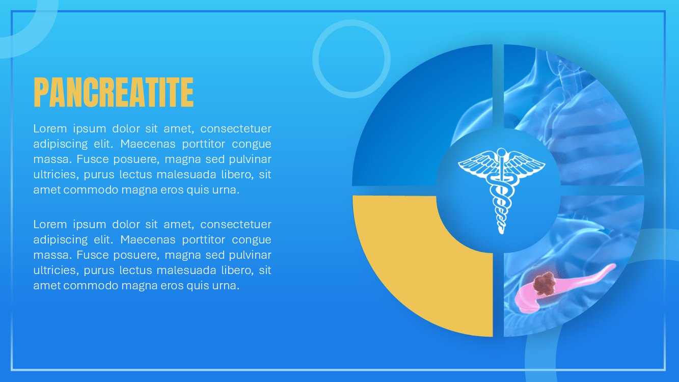 pancreatite-slide7