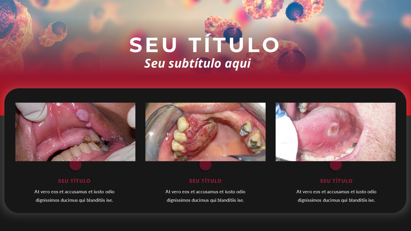 Tabagismo e Câncer Oral – slide 10