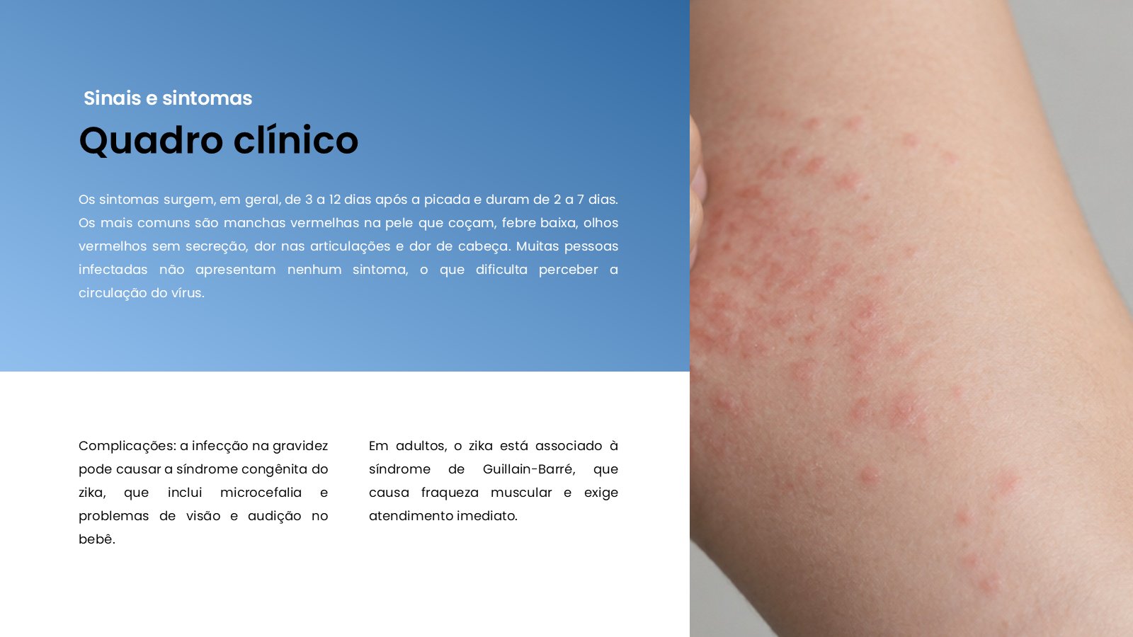 Zika – slide 8